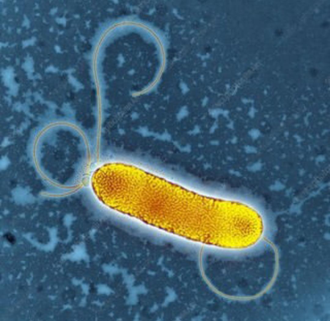 الجراثيم واللامساواة: كيف صنعت الأوبئة الاقتصاد العالمي واتسعت الفجوة الطبقية